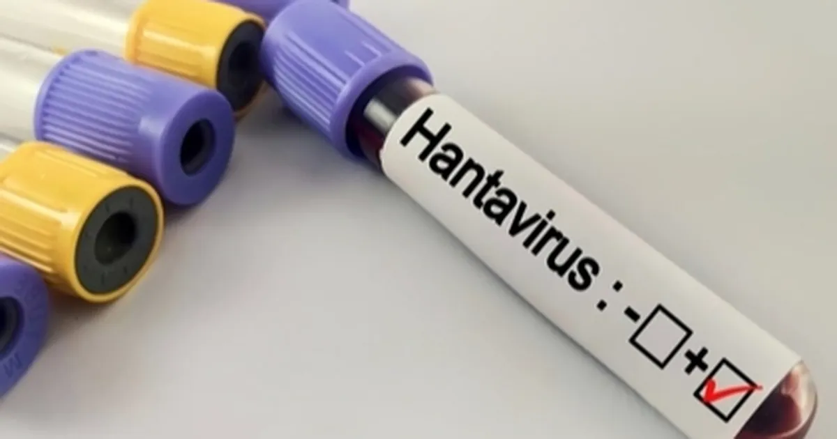 Hantavirüs salgına dönüşür mü? Kapalı alan temizliğinde büyük risk